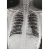 Canon A4 X-Ray Film Yazıcısı  